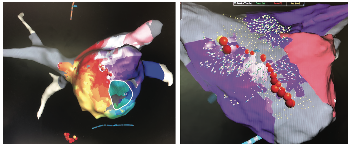 Spotlight Interview John Muir Health Cardiac Rhythm Center